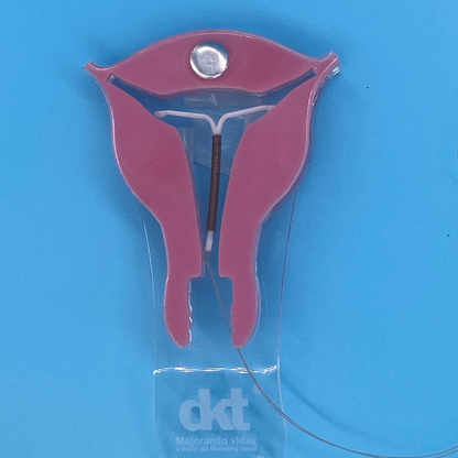 Dispositivo Intrauterino DIU modelo Easy Care marca PREGNA